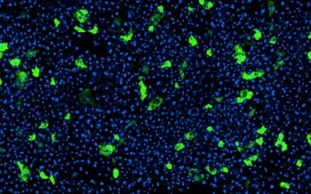 Liver chip aav expression